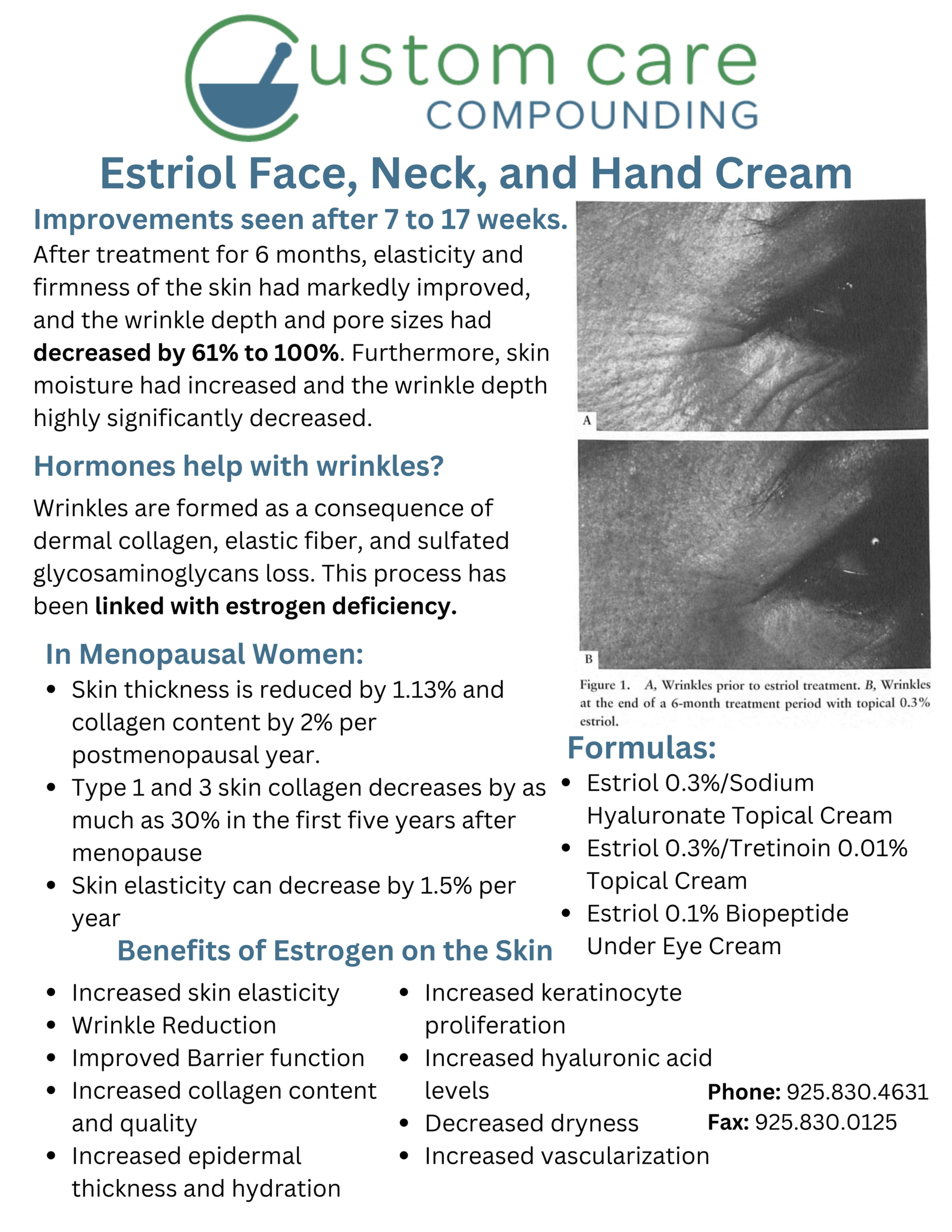 Estriol Wrinkle Cream – Face, neck, and hands